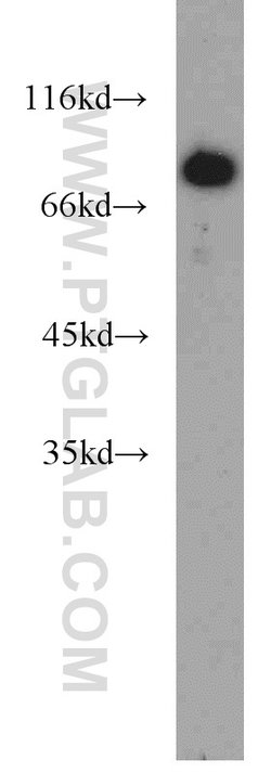 ERCC2 Rabbit anti-Human, Polyclonal, Proteintech:Antibodies:Primary Antibodies