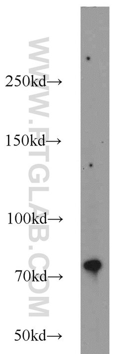 ERCC2 Rabbit anti-Human, Polyclonal, Proteintech:Antibodies:Primary Antibodies
