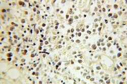 ERCC2 Rabbit anti-Human, Polyclonal, Proteintech:Antibodies:Primary Antibodies
