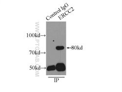 ERCC2 Rabbit anti-Human, Polyclonal, Proteintech:Antibodies:Primary Antibodies