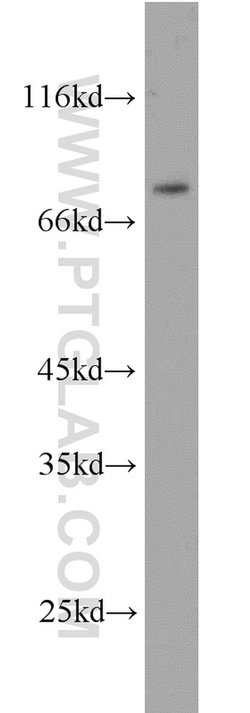 ERCC2 Rabbit anti-Human, Polyclonal, Proteintech:Antibodies:Primary Antibodies