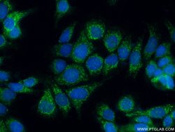 IVD Rabbit anti-Human, Mouse, Rat, Polyclonal, Proteintech:Antibodies:Primary