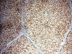 IVD Rabbit anti-Human, Mouse, Rat, Polyclonal, Proteintech:Antibodies:Primary