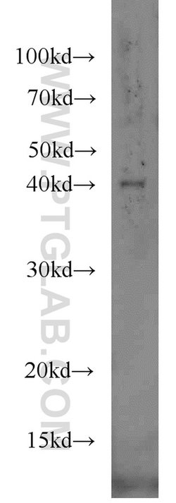 IVD Rabbit anti-Human, Mouse, Rat, Polyclonal, Proteintech:Antibodies:Primary