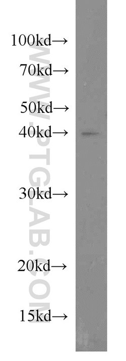 IVD Rabbit anti-Human, Mouse, Rat, Polyclonal, Proteintech:Antibodies:Primary