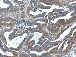 TPT1 Rabbit anti-Human, Mouse, Rat, Polyclonal, Proteintech:Antibodies:Primary