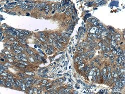 TPT1 Rabbit anti-Human, Mouse, Rat, Polyclonal, Proteintech:Antibodies:Primary
