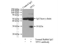 TPT1 Rabbit anti-Human, Mouse, Rat, Polyclonal, Proteintech:Antibodies:Primary
