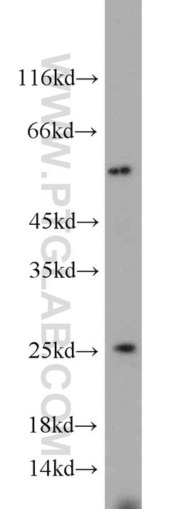 TPT1 Rabbit anti-Human, Mouse, Rat, Polyclonal, Proteintech:Antibodies:Primary