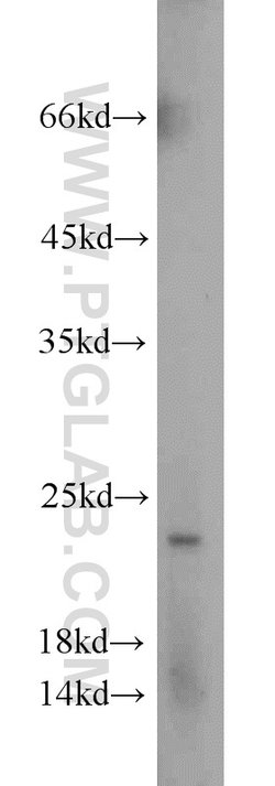 TPT1 Rabbit anti-Human, Mouse, Rat, Polyclonal, Proteintech:Antibodies:Primary
