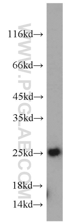 TPT1 Rabbit anti-Human, Mouse, Rat, Polyclonal, Proteintech:Antibodies:Primary