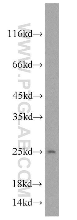 TPT1 Rabbit anti-Human, Mouse, Rat, Polyclonal, Proteintech:Antibodies:Primary