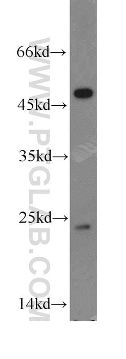 TPT1 Rabbit anti-Human, Mouse, Rat, Polyclonal, Proteintech:Antibodies:Primary