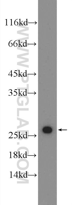 TPT1 Rabbit anti-Human, Mouse, Rat, Polyclonal, Proteintech:Antibodies:Primary