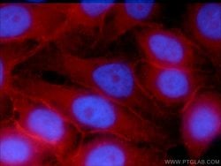 SNAP23 Rabbit anti-Human, Mouse, Rat, Polyclonal, Proteintech 150 &mu;L;