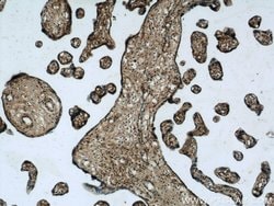 SNAP23 Rabbit anti-Human, Mouse, Rat, Polyclonal, Proteintech 150 &mu;L;