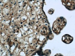 SNAP23 Rabbit anti-Human, Mouse, Rat, Polyclonal, Proteintech 150 &mu;L;