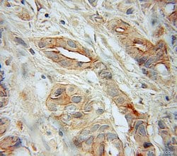 SNAP23 Rabbit anti-Human, Mouse, Rat, Polyclonal, Proteintech 150 &mu;L;