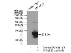 SNAP23 Rabbit anti-Human, Mouse, Rat, Polyclonal, Proteintech 150 &mu;L;