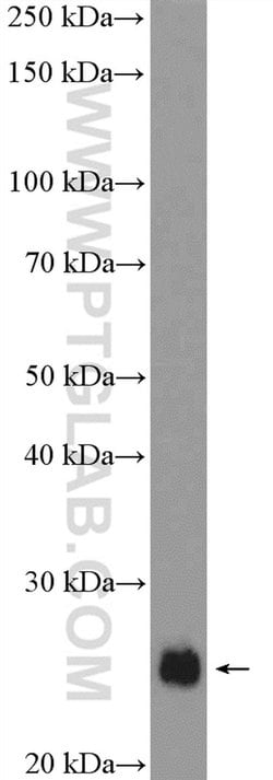 SNAP23 Rabbit anti-Human, Mouse, Rat, Polyclonal, Proteintech 150 &mu;L;