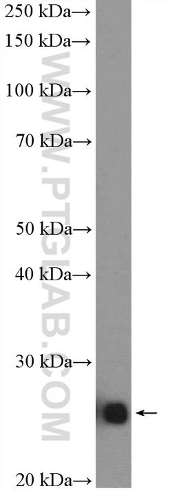 SNAP23 Rabbit anti-Human, Mouse, Rat, Polyclonal, Proteintech 150 &mu;L;