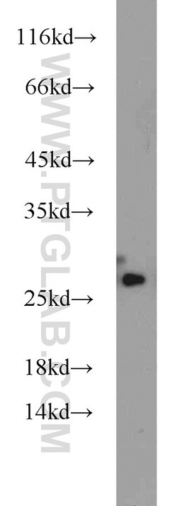 HMGB1 Rabbit anti-Human, Mouse, Rat, Polyclonal, Proteintech:Antibodies:Primary
