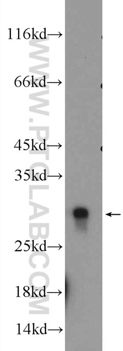 HMGB1 Rabbit anti-Human, Mouse, Rat, Polyclonal, Proteintech:Antibodies:Primary