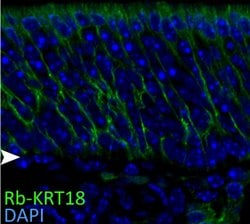 Cytokeratin 18 Rabbit anti-Human, Mouse, Polyclonal, Proteintech:Antibodies:Primary