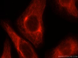 Cytokeratin 18 Rabbit anti-Human, Mouse, Polyclonal, Proteintech:Antibodies:Primary