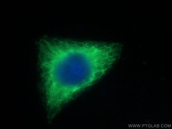 Cytokeratin 18 Rabbit anti-Human, Mouse, Polyclonal, Proteintech:Antibodies:Primary