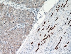Cytokeratin 18 Rabbit anti-Human, Mouse, Polyclonal, Proteintech:Antibodies:Primary