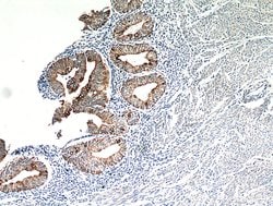 Cytokeratin 18 Rabbit anti-Human, Mouse, Polyclonal, Proteintech:Antibodies:Primary
