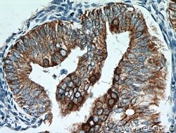 Cytokeratin 18 Rabbit anti-Human, Mouse, Polyclonal, Proteintech:Antibodies:Primary