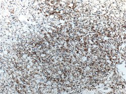 Cytokeratin 18 Rabbit anti-Human, Mouse, Polyclonal, Proteintech:Antibodies:Primary