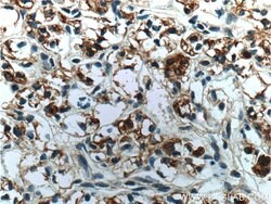 Cytokeratin 18 Rabbit anti-Human, Mouse, Polyclonal, Proteintech:Antibodies:Primary