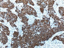 Cytokeratin 18 Rabbit anti-Human, Mouse, Polyclonal, Proteintech:Antibodies:Primary