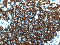 Cytokeratin 18 Rabbit anti-Human, Mouse, Polyclonal, Proteintech:Antibodies:Primary