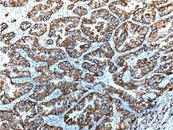 Cytokeratin 18 Rabbit anti-Human, Mouse, Polyclonal, Proteintech:Antibodies:Primary