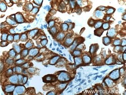 Cytokeratin 18 Rabbit anti-Human, Mouse, Polyclonal, Proteintech:Antibodies:Primary