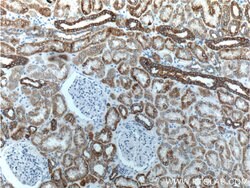 Cytokeratin 18 Rabbit anti-Human, Mouse, Polyclonal, Proteintech:Antibodies:Primary