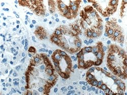 Cytokeratin 18 Rabbit anti-Human, Mouse, Polyclonal, Proteintech:Antibodies:Primary