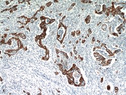 Cytokeratin 18 Rabbit anti-Human, Mouse, Polyclonal, Proteintech:Antibodies:Primary