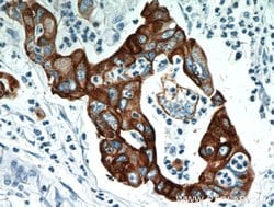Cytokeratin 18 Rabbit anti-Human, Mouse, Polyclonal, Proteintech:Antibodies:Primary