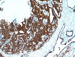 Cytokeratin 18 Rabbit anti-Human, Mouse, Polyclonal, Proteintech:Antibodies:Primary