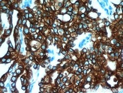 Cytokeratin 18 Rabbit anti-Human, Mouse, Polyclonal, Proteintech:Antibodies:Primary