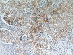 Cytokeratin 18 Rabbit anti-Human, Mouse, Polyclonal, Proteintech:Antibodies:Primary