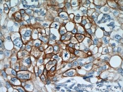 Cytokeratin 18 Rabbit anti-Human, Mouse, Polyclonal, Proteintech:Antibodies:Primary