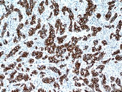 Cytokeratin 18 Rabbit anti-Human, Mouse, Polyclonal, Proteintech:Antibodies:Primary