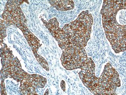Cytokeratin 18 Rabbit anti-Human, Mouse, Polyclonal, Proteintech:Antibodies:Primary