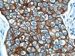 Cytokeratin 18 Rabbit anti-Human, Mouse, Polyclonal, Proteintech:Antibodies:Primary